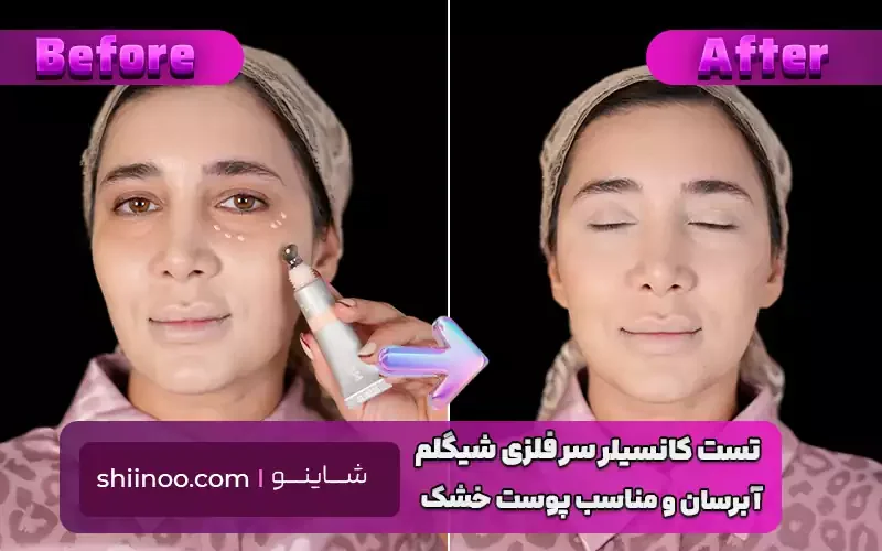 تست کانسیلر سر فلزی شیگلم