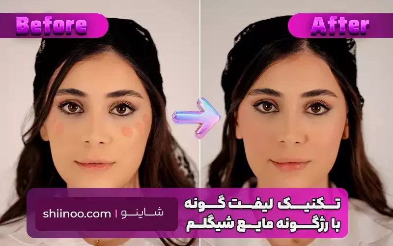 تکنیک لیفت گونه با رژگونه