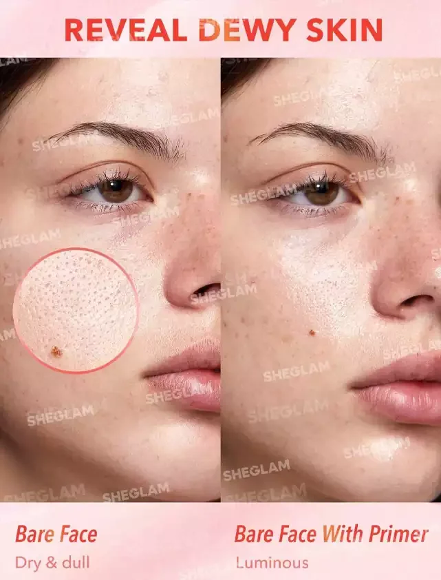 اثر پرایمر شیگلم در کاهش منافذ