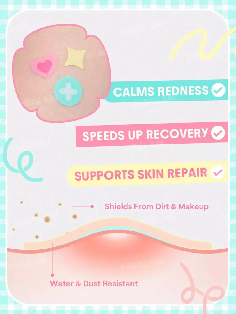 بچ ضد جوش شیگلم