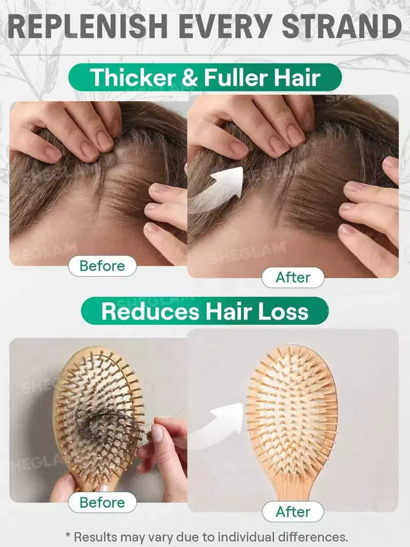 روغن مو زنجبیل شیگلم