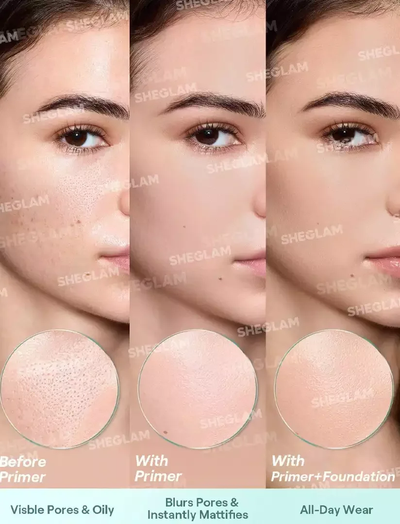 پرایمر منافذ باز شیگلم