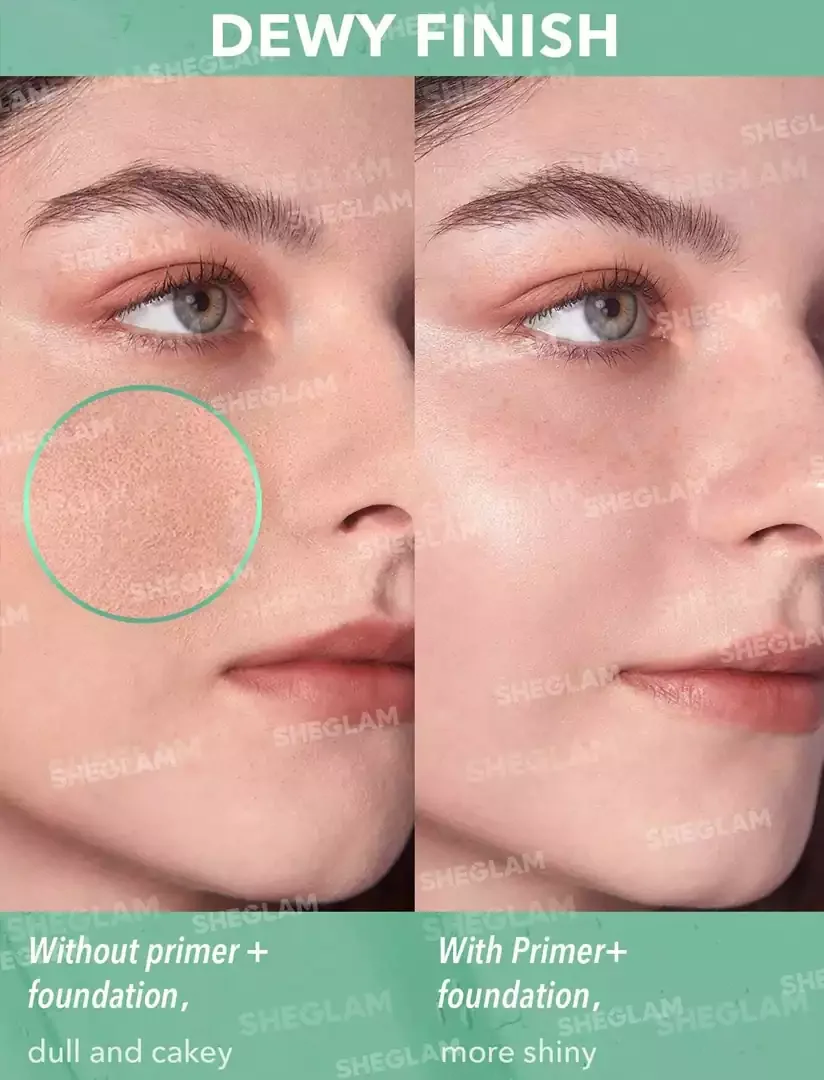 پرایمر آبرسان شیگلم