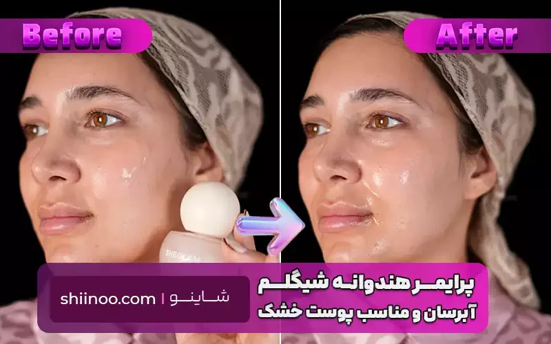 پرایمر هندوانه شیگلم- قبل و بعد